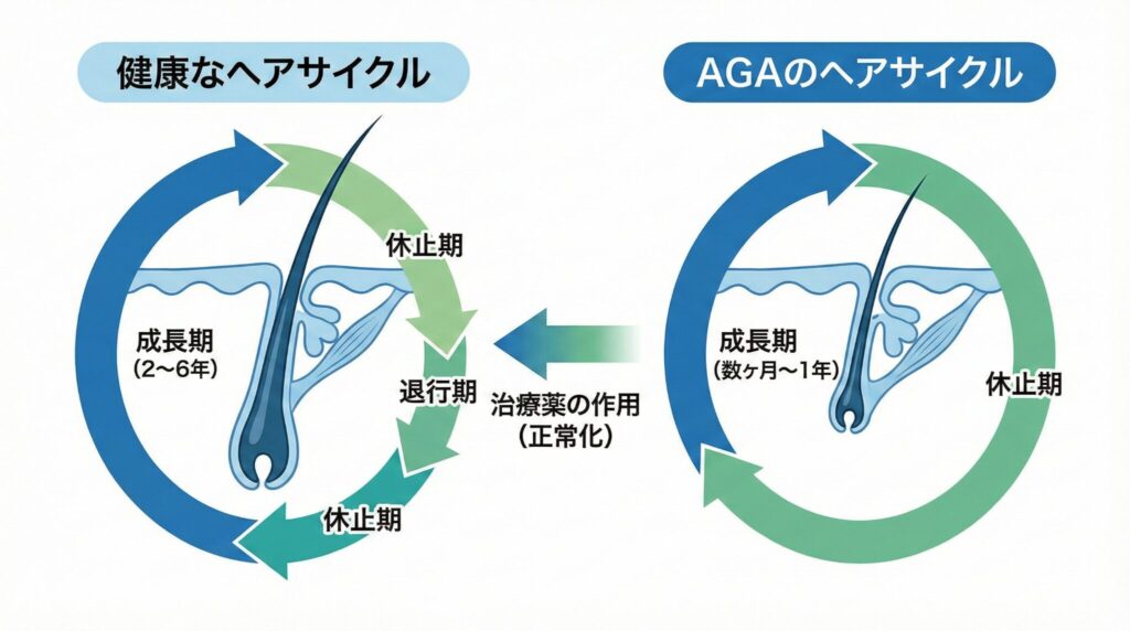AGA治療 ヘアサイクル 正常化 成長期 短縮の比較図