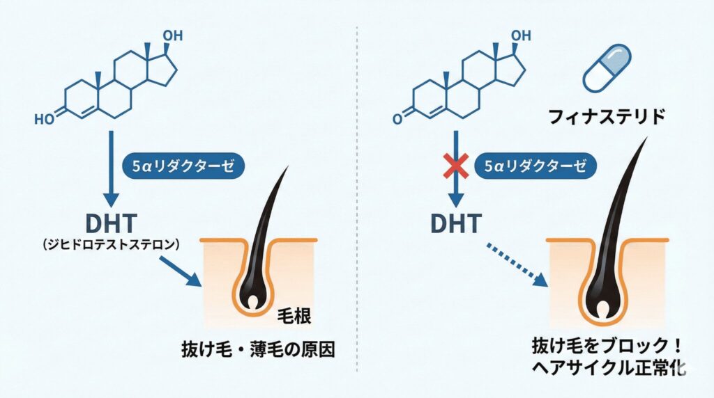 AGA治療薬 フィナステリドの効果と作用機序 ヘアサイクル正常化の図解