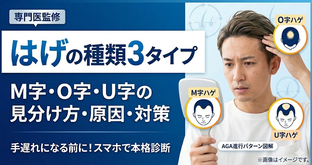 【医師監修】はげの種類は3つ！M字・O字・U字の見分け方と原因・対策を徹底解説