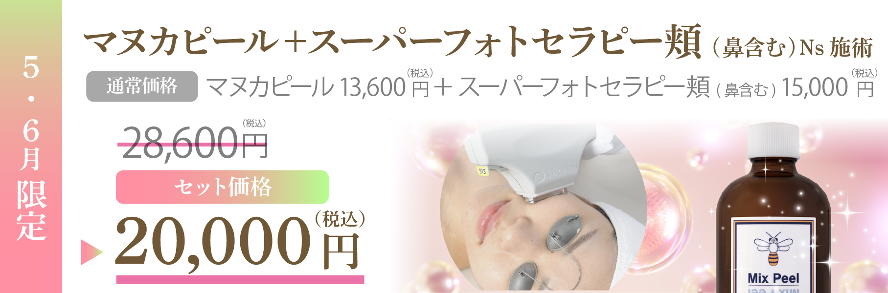 スーパーフォト
