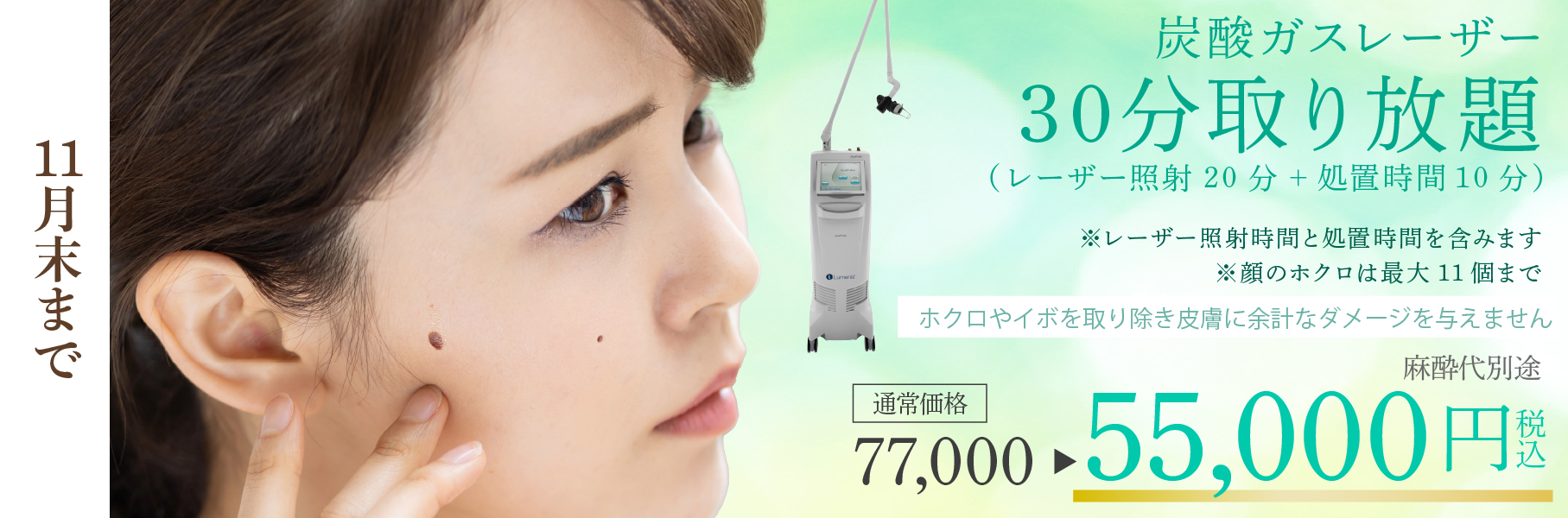 炭酸ガスレーザー