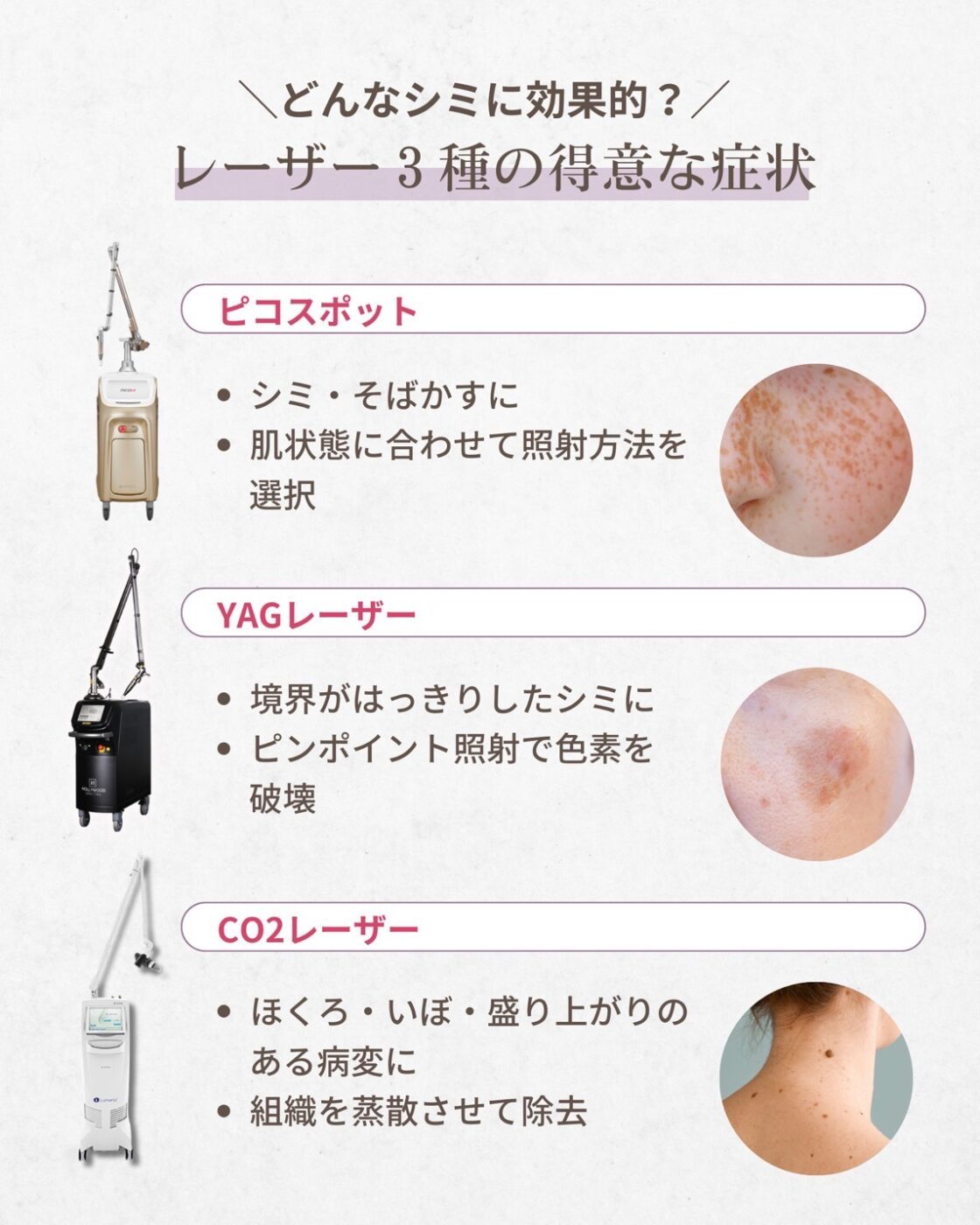 レーザー取り放題　（YAGレーザー・ピコスポット・CO2レーザー）
