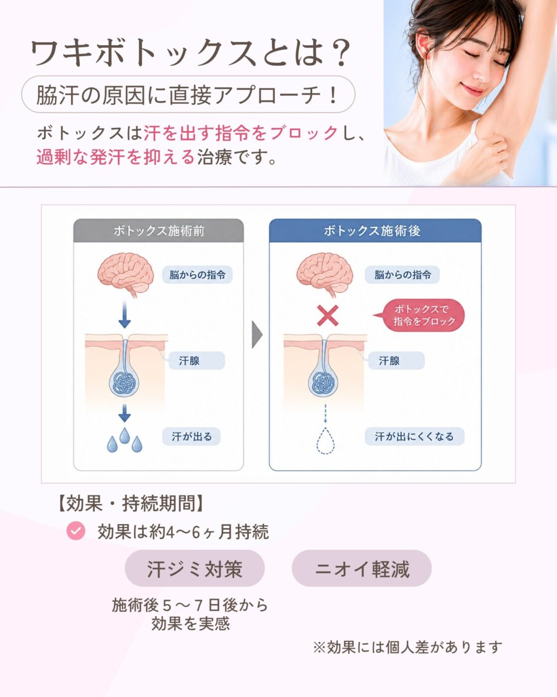 Dr. 施術 ボトックス注射 特別企画