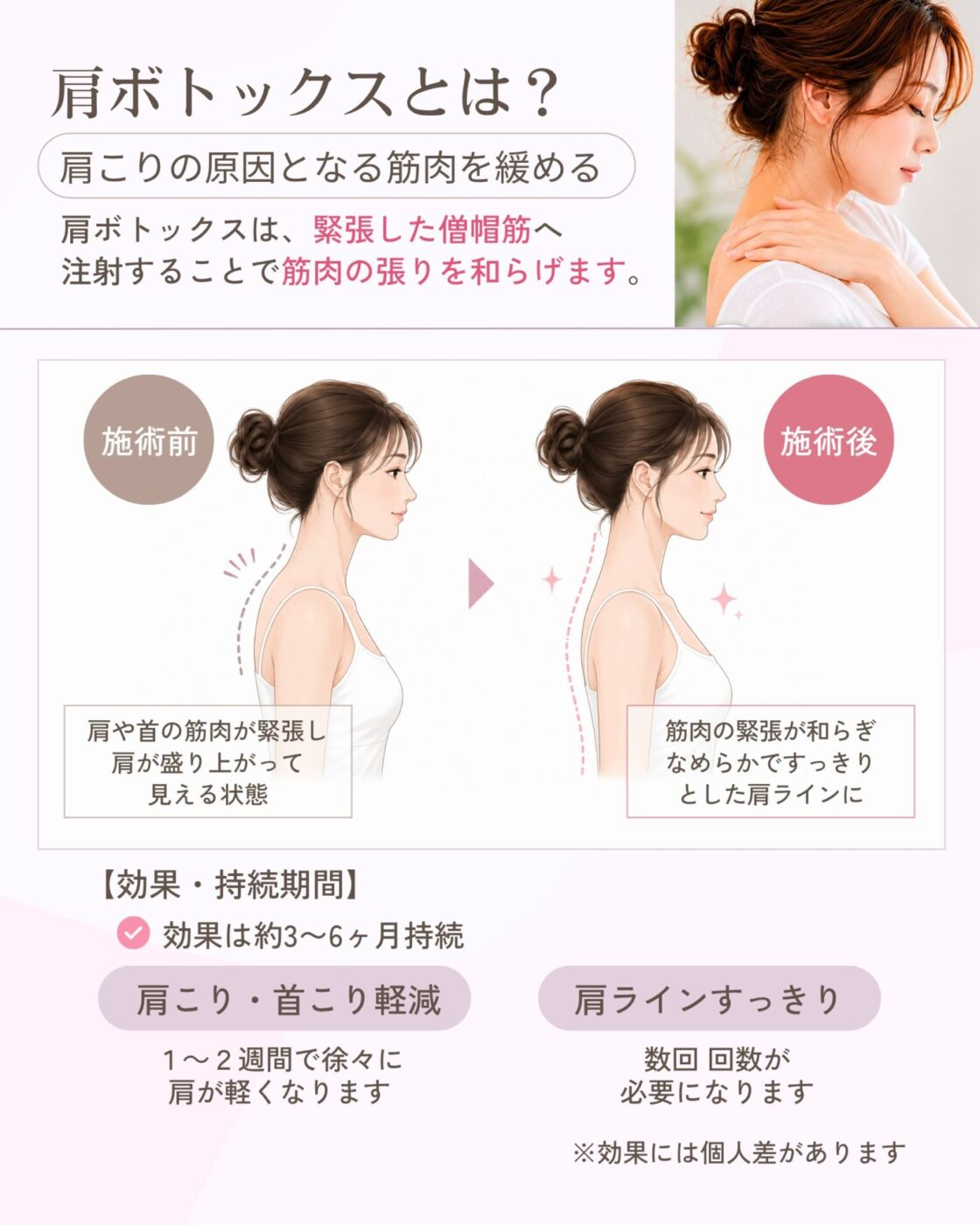 Dr. 施術 ボトックス注射 特別企画