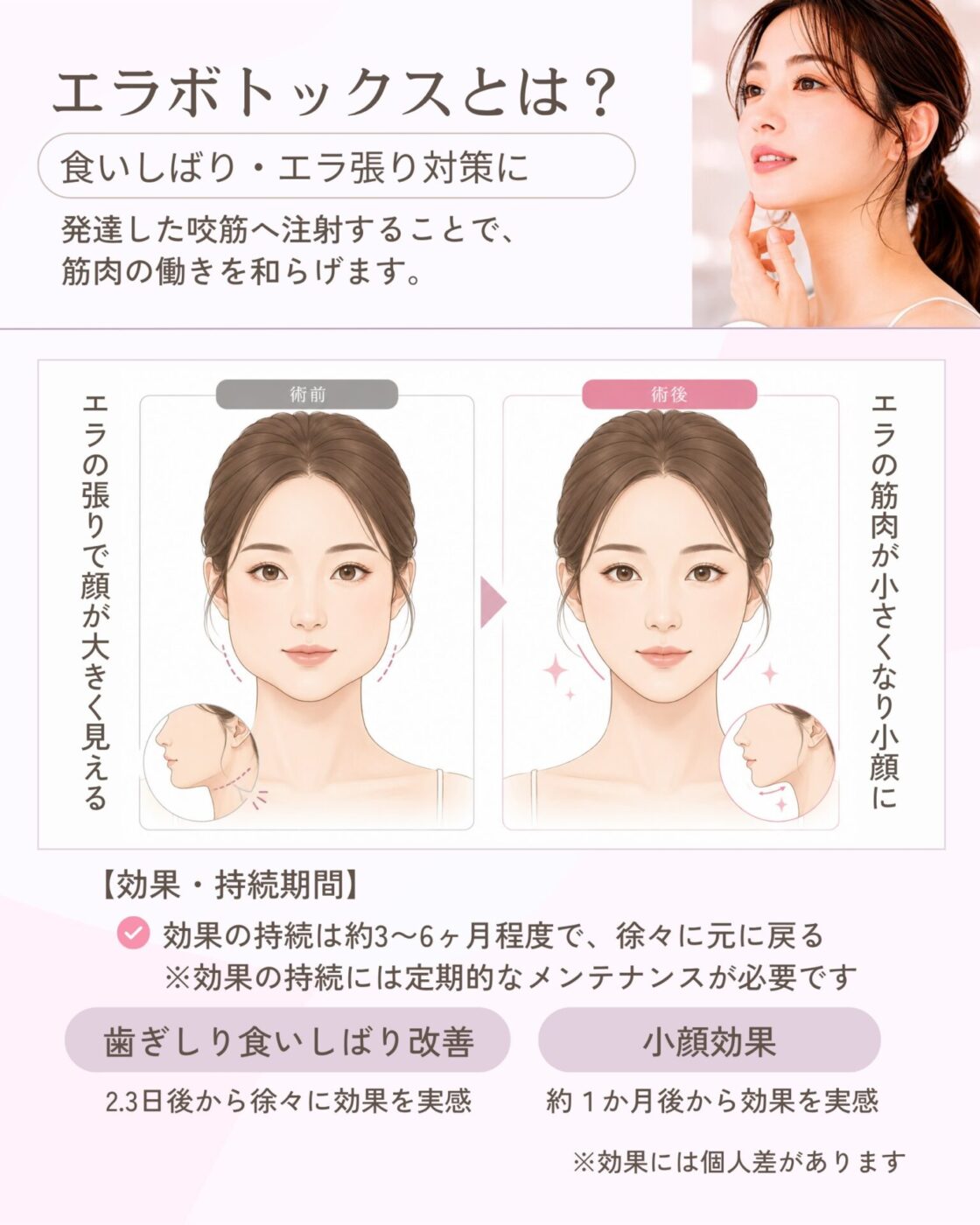Dr. 施術 ボトックス注射 特別企画